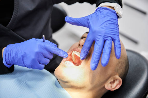 Best Emergency Root Canal Treatment in Upper Sandusky, OH